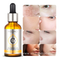 Whitening Moisturizing Vitamin C Serum